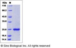 Sino Biological Recombinant Mouse KGF/FGF-7 Protein (His Tag), Quantity:
