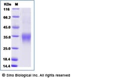 Sino Biological Recombinant Mouse CD8 alpha Protein (His Tag), Amine-Labeled
