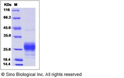 Sino Biological Recombinant Mouse MCP-1/CCL2 Protein (His Tag), Quantity: