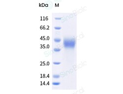Sino Biological Recombinant Mouse CD16/FCGR3/Fc gamma RIII Protein (ECD,