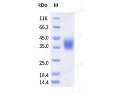Sino Biological Recombinant Mouse CD16/FCGR3/Fc gamma RIII Protein (ECD,