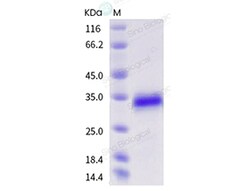 Sino Biological Recombinant Mouse CD40/TNFRSF5 Protein (His & AVI Tag),