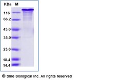 Sino Biological Recombinant Mouse LDLR/LDL Receptor Protein (His Tag),