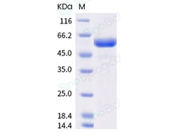 Sino Biological Recombinant Mouse CD39L3/ENTPD3 Protein (His Tag), Quantity: