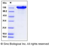 Sino Biological Recombinant Mouse ACE2 Protein (His & hFc Tag), Quantity: