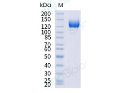Sino Biological Recombinant Mouse ACE2 Protein (ECD, hFc Tag), HPLC-verified,