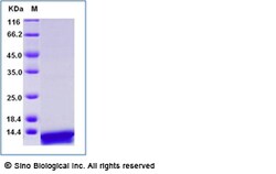 Sino Biological Recombinant Mouse S100A8 Protein (His Tag), Quantity: Each