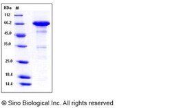 Sino Biological Recombinant Mouse MCP-2/CCL8 Protein (His & NusA Tag),