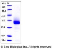 Sino Biological Recombinant Mouse FGF-18 Protein (His Tag), Quantity: Each