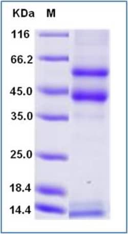 Sino Biological Recombinant Mouse TGF beta 2 Protein (His Tag), Amine-Labeled