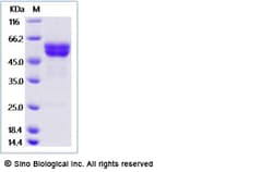 Sino Biological Recombinant Mouse TROY/TNFRSF19 Protein (ECD, mFc Tag),