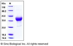 Sino Biological Recombinant Mouse CXCL16 Protein (His Tag), Quantity: Each