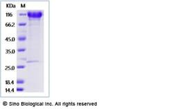 Sino Biological Recombinant Mouse gp130/IL6ST Protein (ECD, hFc Tag), Quantity: