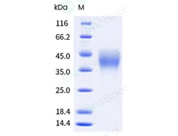 Sino Biological Recombinant Mouse PD-1 Protein (ECD, His Tag), HPLC-verified,