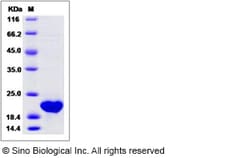 Sino Biological Recombinant Mouse Oncostatin M/OSM Protein, Quantity: Each