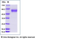 Sino Biological Recombinant Mouse CD28 Protein (ECD, Dimer, hFc Tag), HPLC-verified,
