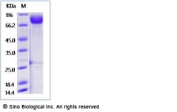 Sino Biological Recombinant Mouse IL-13 R alpha 1/IL13RA1 Protein (ECD,