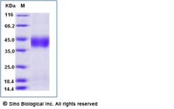 Sino Biological Recombinant Mouse ASGR1 Protein (His Tag), Amine-Labeled
