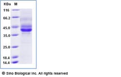 Sino Biological Recombinant Mouse BCMA Protein (ECD, hFc & AVI Tag), Biotinylated,