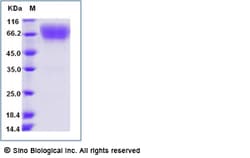 Sino Biological Recombinant Mouse B7-2/CD86 Protein (ECD, hFc Tag), Quantity: