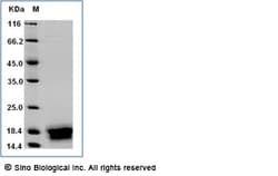 Sino Biological Recombinant Mouse CCL19/MIP-3b Protein (His Tag), Quantity: