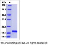 Sino Biological Recombinant Mouse basic FGF/FGF2 Protein (His Tag), HPLC-verified,