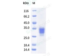 Sino Biological Recombinant Mouse CD16-2/FCGR4/Fc gamma RIV Protein (His