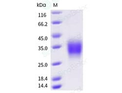 Sino Biological Recombinant Mouse CD32B/Fcgr2b Protein (His Tag), HPLC-verified,