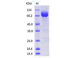 Sino Biological Recombinant Mouse PD-L1/B7-H1 Protein (ECD, His & hFc Tag),