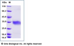 Sino Biological Recombinant Mouse ANGPTL3/Angiopoietin-like 3 Protein (His