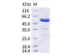 Sino Biological Recombinant Mouse ANGPTL3/Angiopoietin-like 3 Protein (His