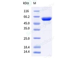 Sino Biological HPV18 E6 Protein (N-His-MBP & C-AVI Tag), Quantity: Each