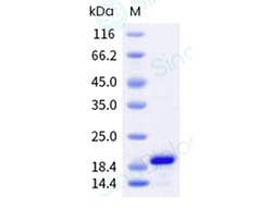 Sino Biological HPV16 E6 Protein (His Tag), Quantity: Each of 1