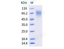 Sino Biological Varicella-zoster virus (VZV) Glycoprotein E Protein(MALS-verified),