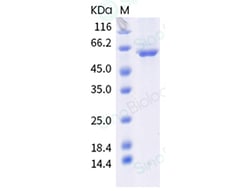 Sino Biological Influenza B (B/Brisbane/60/2008) Nucleoprotein / NP Protein