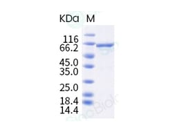 Sino Biological Influenza B (B/Colorado/06/2017) Nucleoprotein / NP Protein