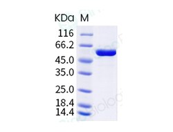 Sino Biological Influenza A H1N1 (A/Brisbane/02/2018) Nucleoprotein / NP