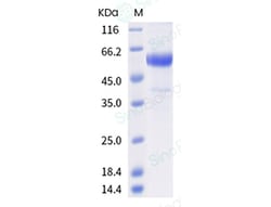 Sino Biological Influenza A H3N2 (A/Kansas/14/2017) Neuraminidase / NA