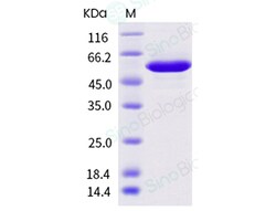 Sino Biological Influenza A H3N2 (A/Hong Kong/45/2019) Nucleoprotein /
