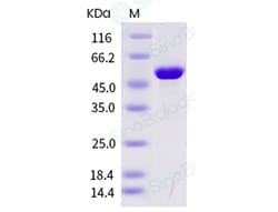 Sino Biological Influenza A H3N2 (A/Hong Kong/2671/2019) Nucleoprotein