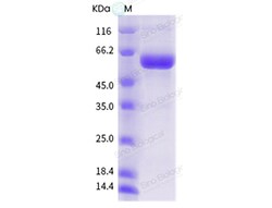 Sino Biological Influenza B (B/Lee/1940) Neuraminidase / NA (His Tag),