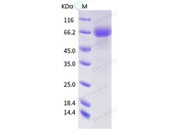 Sino Biological Influenza A H3N2 (A/swine/China/JG20/2019) Neuraminidase