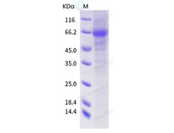 Sino Biological Influenza A H1N2 (A/swine/Alberta/SD0217/2017) Neuraminidase