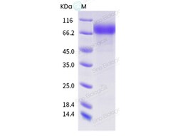 Sino Biological Influenza A H1N2 (A/swine/Papenburg/IDT12653/2010) Neuraminidase
