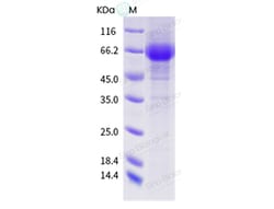 Sino Biological Influenza A H1N2 (A/Swine/Spain/SF12091/2007) Neuraminidase