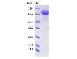 Sino Biological Influenza A H3N2 (A/Australia/NHRC0001/2005) Neuraminidase