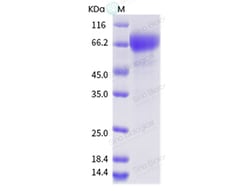 Sino Biological Influenza A H3N2 (A/Hong Kong/CUHK19579/1998) Neuraminidase