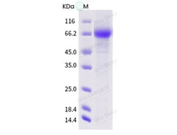 Sino Biological Influenza A H3N2 (A/swine/Italy/526/1985) Neuraminidase