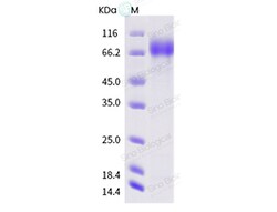 Sino Biological Influenza A H3N2 (A/Hong Kong/107/1971) Neuraminidase /