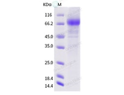 Sino Biological Influenza A H3N2 (A/Albany/18/1968) Neuraminidase / NA